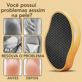 Pedra Depiladora e Esfoliadora em Nanoglass