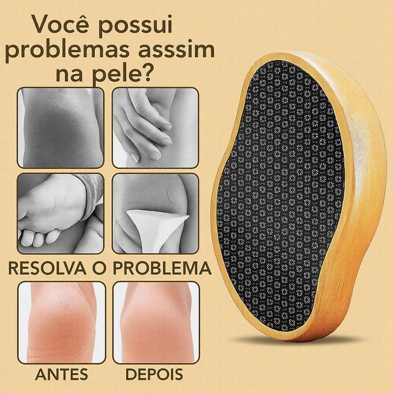 Pedra Depiladora e Esfoliadora em Nanoglass